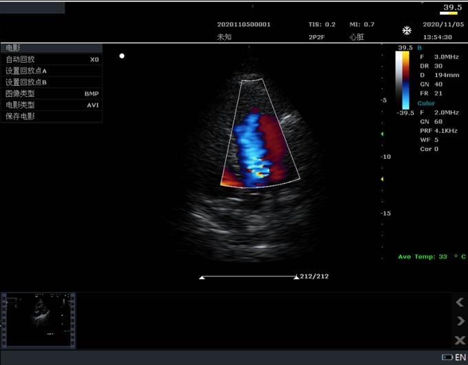å¿èè¡æµ